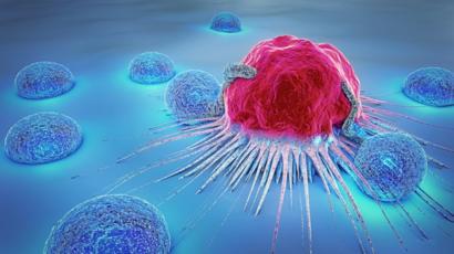 _103278060_cancer2
