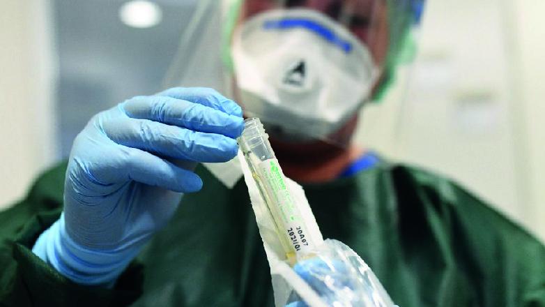 diagnosticos covid