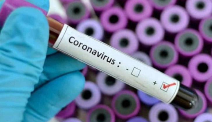 coronavirustest