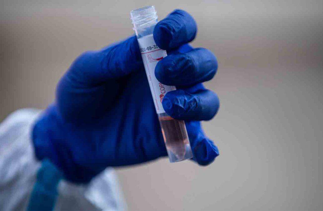 Coronavirus en Uruguay-